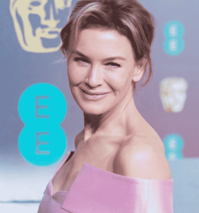 What Happened To Renee Zellweger Nose Before And After Did She