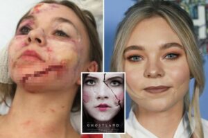 Was Taylor Hickson In A Car Accident