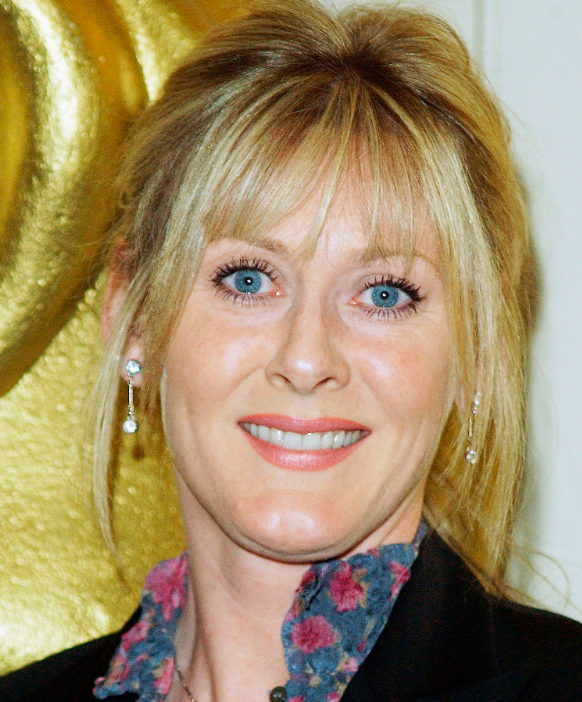 The Secret Behind Sarah Lancashire's Stunning Smile Her Before and