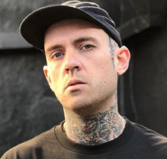 Is Adam22 Bald? Discovering the Facts About His Hair Transplant