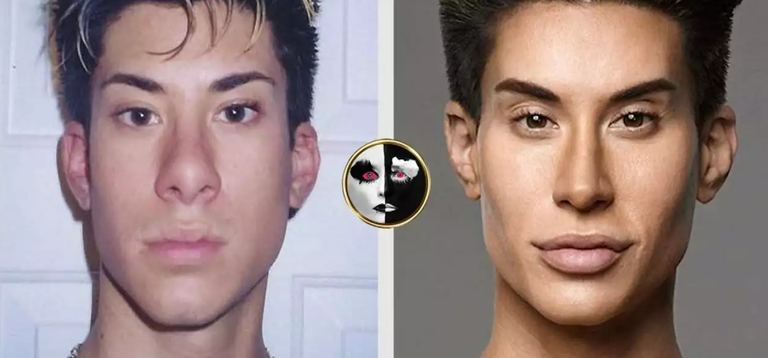 Before and After Plastic Surgery Jayson McNaughton, Justin Jedlica Husband