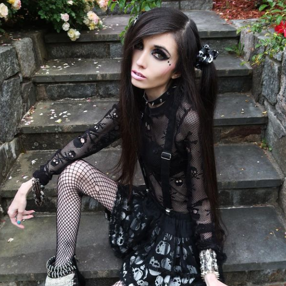 Eugenia Cooney's Weight Loss Before And After, Anorexia Nervosa And