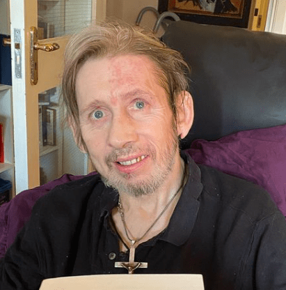 Shane MacGowan Weight Loss: What Happened To His Teeth? Dental Health ...