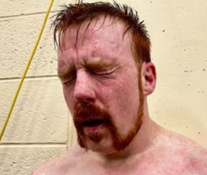 Sheamus 