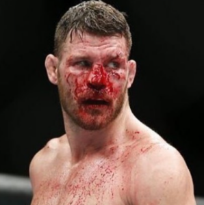 Michael Bisping  